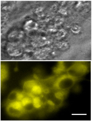 Fig. 1: Fluorescent microscope images of unstained pancreatic alpha cells (top) and the same cells 24 hours after staining with glucagon yellow (bottom) (scale bar, 20 µm).