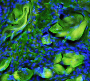 Fig. 1: A fluorescence microscopy image of the scaffold-embedded cells showing the integration of the fibers (yellow-green) with differentiated cells after implantation. Cell nuclei are stained blue.