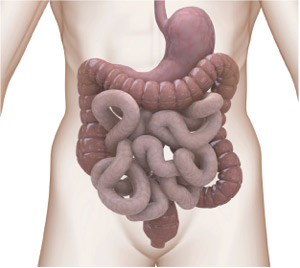 With the identification of several genes associated with ulcerative colitis, relief may be a step closer for sufferers of this chronic, inflammatory condition of the large intestine.