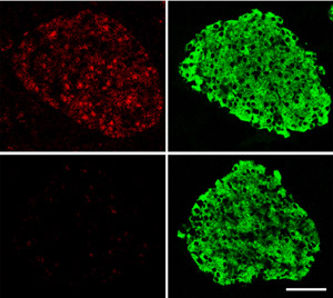 Fig. 1: STAT3 (red) and insulin (green) expression in the pancreas of control mice (top) and STAT3-deficient mice (bottom). Glucose regulation and blood vessel development was abnormal in the STAT3-deficient mice (scale bar, 50 µm).