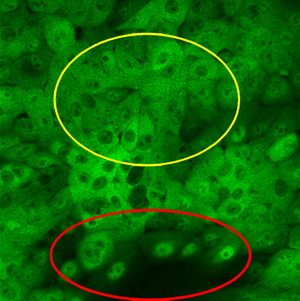 Fig. 1: Growth of cultured human breast epithelial cells is regulated by localization of the YAP protein (green). In densely populated areas (top circle), Hippo-mediated signaling blocks growth by keeping YAP sequestered from the nucleus. In less-crowded regions (bottom circle), YAP is translocated to the nucleus and partners with TEAD to activate growth.