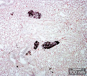 Fig. 1: Staining for cancer-specific antigen reveals colonies of disseminated tumor cells (dark spots) within the lungs of a 5-week-old RET.AAD mouse.