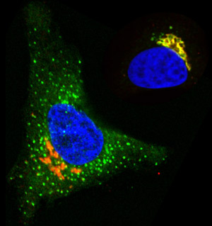 Fig. 1:  In cells stimulated with EGF (left), but not control cells (right), O-glycosylation enzymes (green) are redistributed from the Golgi apparatus (orange) to the endoplasmic reticulum (blue, nucleus).  