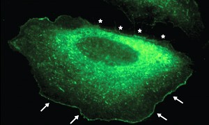 Fig. 1: In migrating cells, fluorescently labeled IRSp53 is localized at the leading edge (arrows) but is absent from areas that are retreating (stars).