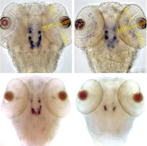 Fig. 1: Normal zebrafish embryos (left) have more dopamine-producing neurons than embryos lacking the WD40 domain of LRRK2 (right), as revealed by staining for tyrosine hydroxylase (top) and dopamine transporter (bottom).