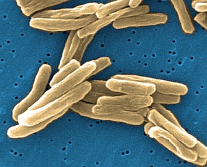 Electron microsopy image of Mycobacterium tuberculosis bacteria