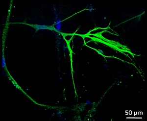 Immunofluorescence image of neuronal protein markers expressed in human mesenchymal stem cells differentiated in gelatin-HPA hydrogels.
