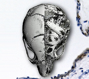 Composite image showing the skull of a normal mouse (left) and a mouse with progeria (right). Background image is a section from the pulmonary artery of a progeric mouse, showing extensive apoptosis (brown staining) in the vascular smooth muscle.