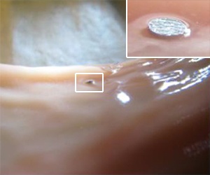 The microtag embedded in pig intestine