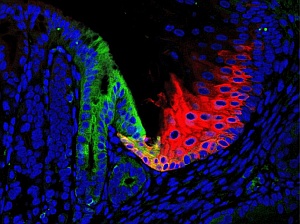 Residual embryonic cells (green) in the adult mouse give rise to Barrett’s-like metaplasia, and may be prevented from spreading by guardian cells (red).