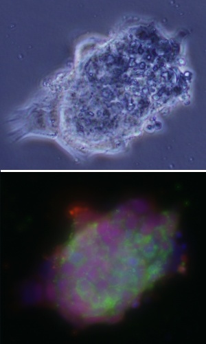 A colony of mouse embryonic stem cells before (top) and after (bottom) staining that indicates the presence of Oct4 (red) – a master gene that controls stem cell status. The molecular signaling researched by Lee and co-workers was found to regulate Oct4 expression and move cell activity from a state of self-renewal towards differentiation into specific cell types.