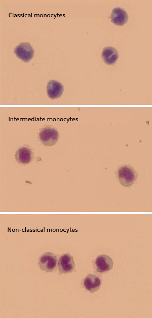 Monocytes are divided into three subtypes according to CD14 and CD16 expression