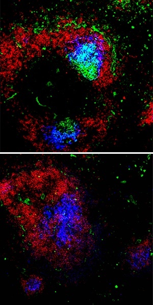 Germinal center (GC) B cells (green) are readily detectable together with dendritic cells (blue) in the spleens of wild-type mice (top) after immunization.  However, in the absence of Dicer, B cells fail to accumulate within GCs (bottom).
