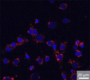 Image of mammalian cancer cells incubated with red light-emitting quantum dots. The cell nuclei are stained blue.