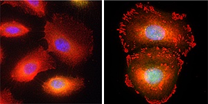 TAp63β-mediated focal adhesion in Caski cells, with the focal adhesion protein vinculin in red and DNA in blue