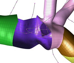 Illustration of a hole that was made according to a branch of the liver vascular system. The different parts of the combined mesh are displayed in different colors.