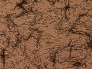Uric acid crystals and immune cells in cell culture