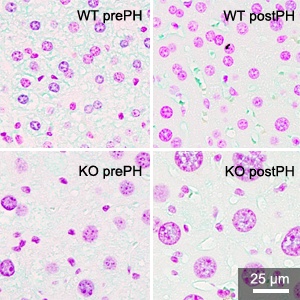 Livers from Cdk1 knockout (KO) mice (bottom row) display fewer but larger cells compared to wild type (WT) mice (top row), both before and after partial hepatectomy (PH)