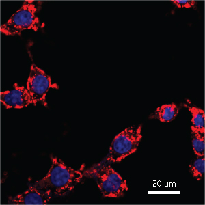 Fluorescence image of breast cancer cells incubated with dye-loaded BSA nanoparticles showing that the nanoparticles have entered the cell cytoplasms (red) but not the nuclei (blue)