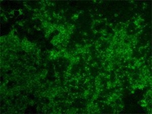 Infected cells stained with anti-Chikungunya virus plasma