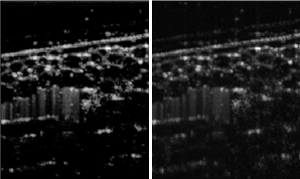 An optical-coherence tomogram of onion skin, reconstructed with the new method developed by Seck and his co-workers (left), shows sharper details than the original image (right).