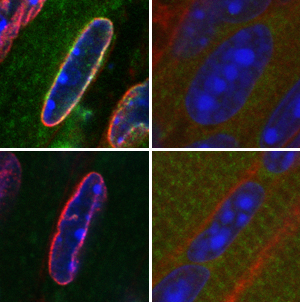 In normal muscle cells (left), heterochromatin (blue) is localized at the edges of the nucleus. In cells lacking both LBR and LamA/C (right), heterochromatin is in the center of the nucleus.
