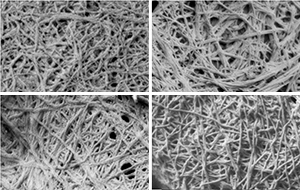 Electron microscopy images reveal that amyloids formed by the designed peptide LD6 (top left) have a similar structure to naturally occurring amyloids in diabetes type 2 (top right), Alzheimer’s disease (bottom left) and thyroid cancer (bottom right).