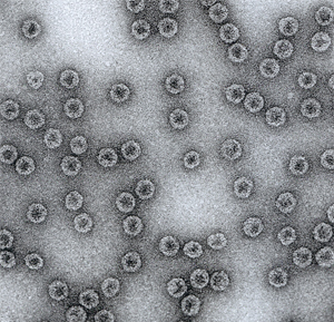 A scanning electron micrograph of Cytos’ virus-like particle (VLP).