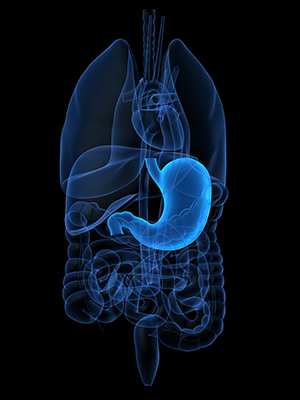 Gastric cancer, caused by infection with the bacterium Helicobacter pylori, is second only to lung cancer as the leading cause of death.