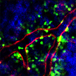 Plerixafor increases the number of neutrophils in the blood, in part, by preventing them from being trafficked back into the bone marrow environment, shown here with neutrophils in green, blood vessels in red and collagen fibers in blue.