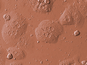 Human pluripotent stem cells, such as human embryonic stem cells (above), can differentiate into specific cell types under appropriate conditions; the HEXIM1 protein helps with this differentiation.