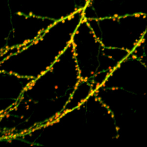 The sorting nexin SNX27 (green) is found primarily at dendritic spines, as indicated by overlapping fluorescence with postsynaptic density protein-95 (PSD-95; red).