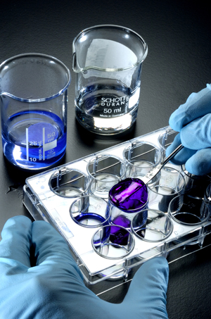 Hydrogels offer a promising infrastructure for promoting the repair of damaged cartilage.