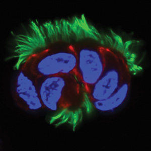 Cells from the human airway covered with hundreds of motile cilia (green).