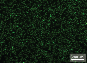 Fluorescence microscopy image showing green fluorescent protein expression in sonoporated human B cells.