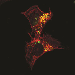 Overexpression of protein PTP4A3 (red) promotes the maturation of autophagosomes (yellow), triggering the self-destruction of healthy cells and promoting cancer cell growth in ovarian cancer.