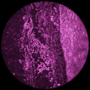 Blocking the spliceosome could inhibit the growth of MYC-driven tumors.