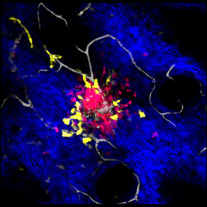 Researchers uncover part of the mechanism governing the recruitment of blood neutrophils (red) and dermal dendritic cells (yellow) to a laser-induced sterile injury in mice.