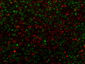 Human embryonic stem cells with fluorescence reporters, which aided the discovery of novel regulators of stem cell potency. Red and green fluorescence demarcate different phases of the cell cycle.