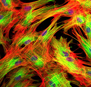 Skin cells were subjected to stress so the researchers could examine the cellular pathways of the stress response.