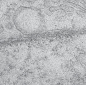 An electron microscopy image of a nuclear enveloped-associated endosome (circular object, top left hand quadrant) in close apposition with the nuclear envelope (darker grey line).