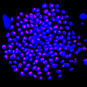ATP-binding-cassette G2 (ABCG2)-positive skin cells (blue) show positive staining of cell proliferation marker Ki-67 (red), which marks cells with the most growth potential.
