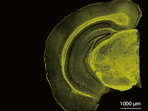 The fluorescent probe, BD-Oligo, developed by A*STAR detects amyloid-beta oligomers (yellow) in an Alzheimer's disease-affected brain.