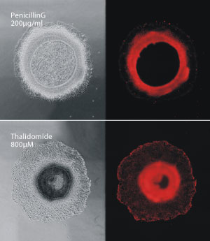 Compounds that cause birth defects, such as thalidomide (bottom), disrupt the ring-like formation of colonies of human stem cells, compared with compounds that are not toxic to the developing fetus, such as penicillin G (top).