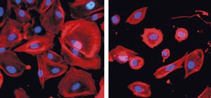 Human renal proximal tubule cells treated with Dexamethasone (non toxic, left) and Bismuth Oxide (toxic, right).