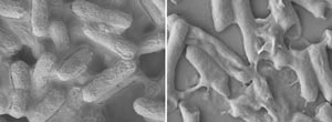 A*STAR researchers have developed a synthetic molecular complex capable of destroying common bacteria in seconds. Above are E.coli cells before (left) and after (right) treatment with the new material, which works by penetrating and destroying the cells’ membranes.