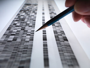 Patterns of repetition in DNA could be associated with the risk of developing kidney inflammation.