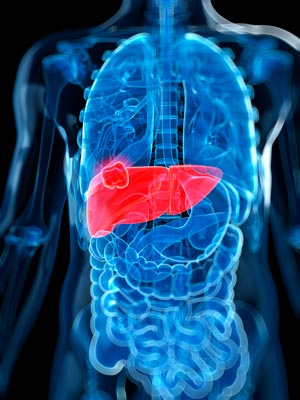 Next-generation DNA sequencing of multiple samples from liver cancer tumors show the high genetic diversity and spatial growth patterns of the tumors for the first time.