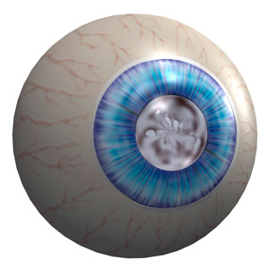 A*STAR researchers, together with an international team of scientists, uncover a rare, protective mutation that appears to prevent glaucoma and the progression of exfoliation syndrome.