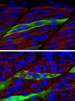 Fast-twitch skeletal muscle from normal zebrafish larvae (top) show the characteristic striated pattern formed by the long chains of sarcomeres within each fiber, whereas muscle from frozen mutant larvae of the same age (bottom) lack any striation.